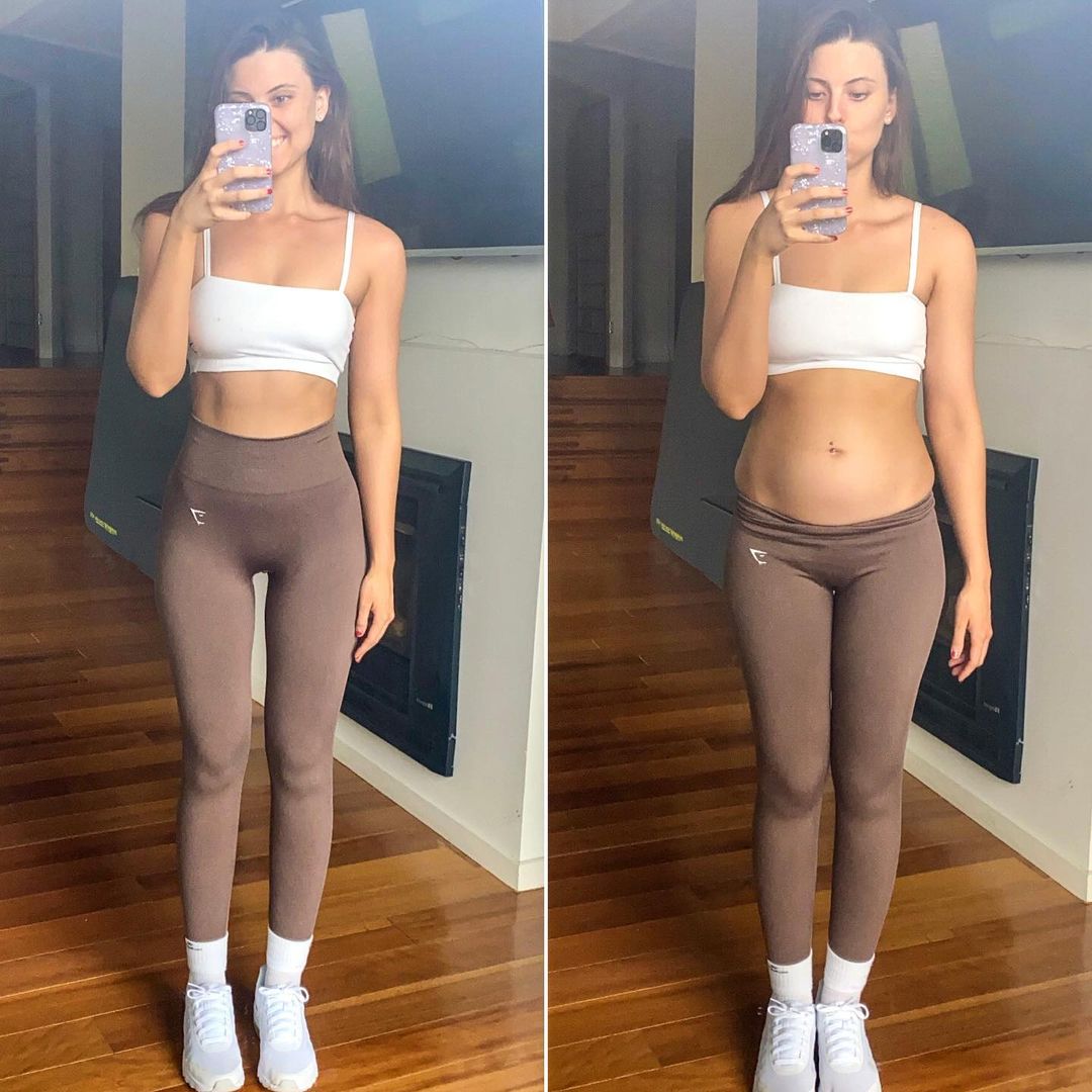 #11 Bree Lenehan | A Famous Influencer Defies Unrealistic Beauty Standards By Posting Photos Of Her Natural Body | Zestradar