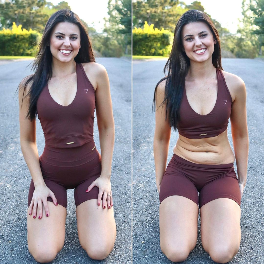 #12 Bree Lenehan | A Famous Influencer Defies Unrealistic Beauty Standards By Posting Photos Of Her Natural Body  | Zestradar