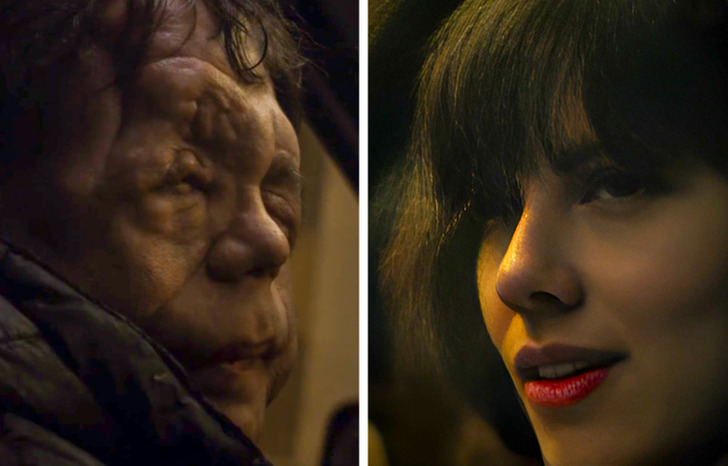#6 | How Adam Pearson Melted The Hearts Of Fans (and Scarlett Johansson) | Zestradar