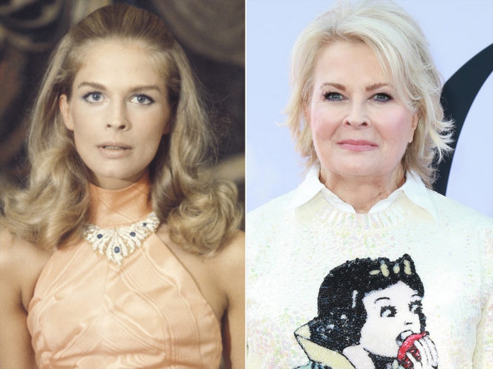 Candice Bergen | 8 Stunning Stars From the 70s: Then and Now | Zestradar