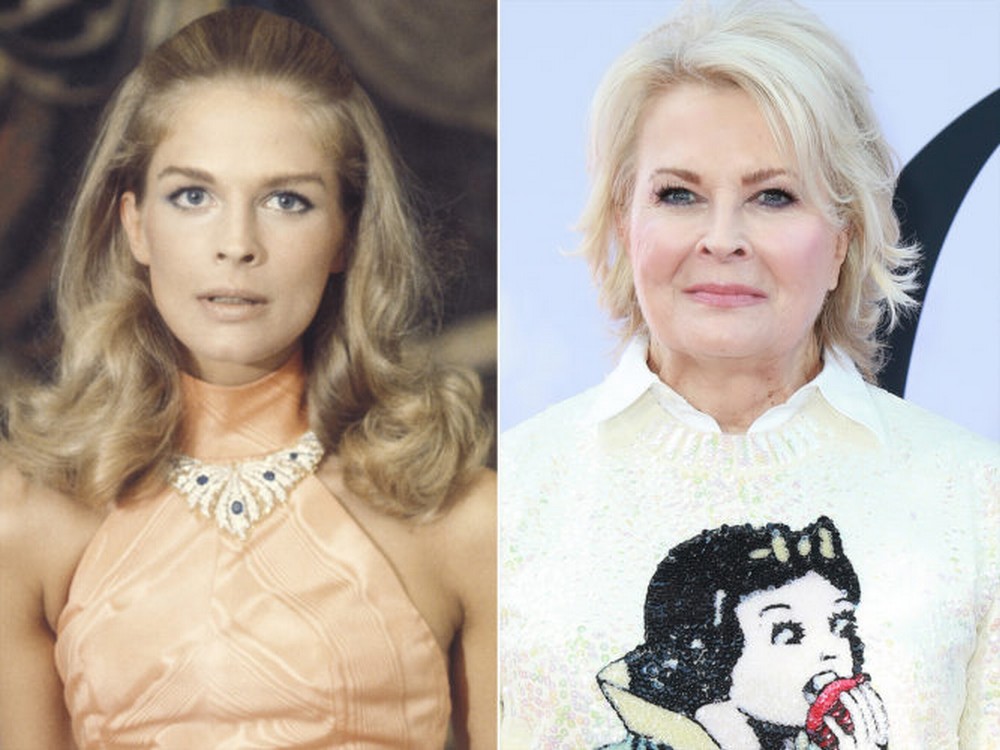 Candice Bergen | 8 Stunning Stars From the 70s: Then and Now  | Zestradar