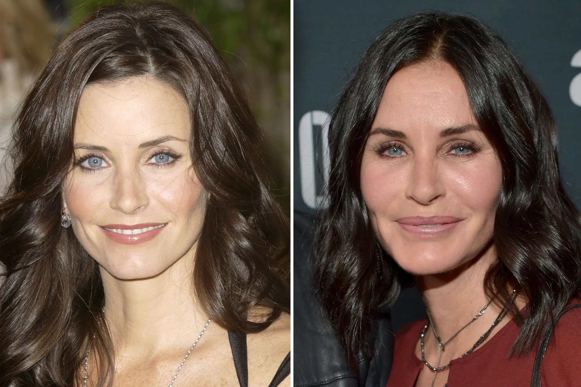 Courtney Cox | 15 Celebs Who Openly Admit to Going Under the Knife | Zestradar