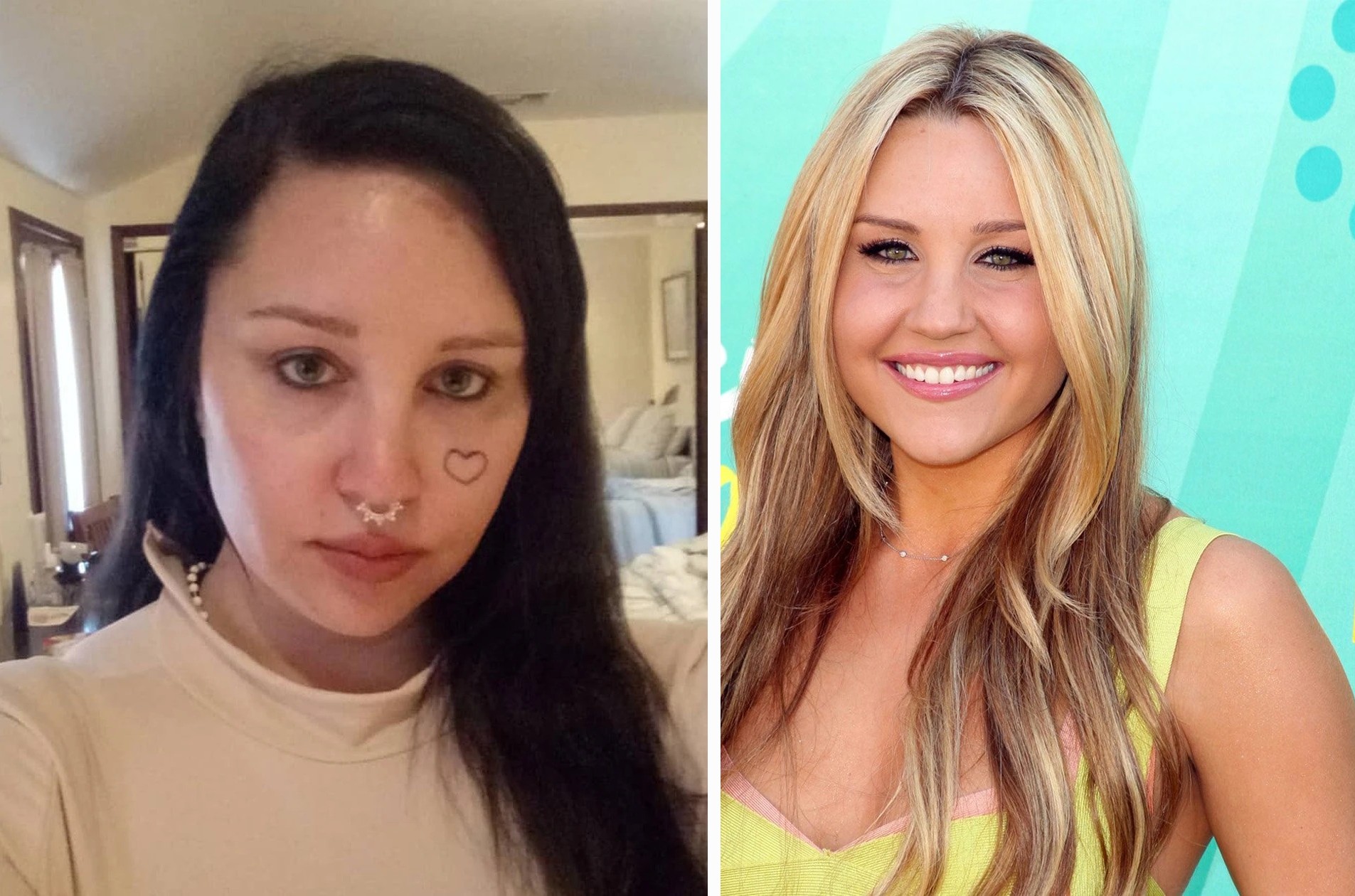 Amanda Bynes | 15 Celebs Who Openly Admit to Going Under the Knife | Zestradar