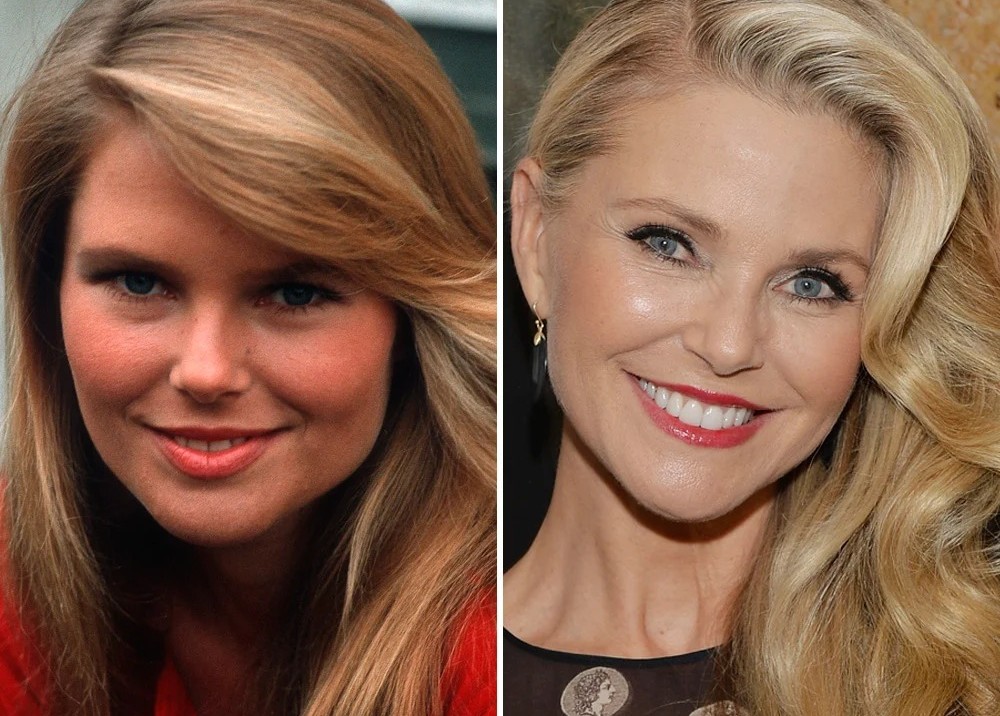 Christie Brinkley | 15 Celebs Who Openly Admit to Going Under the Knife | Zestradar