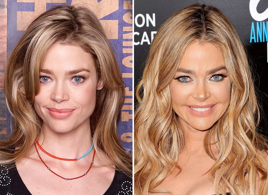 Denise Richards | 15 Celebs Who Openly Admit to Going Under the Knife | Zestradar