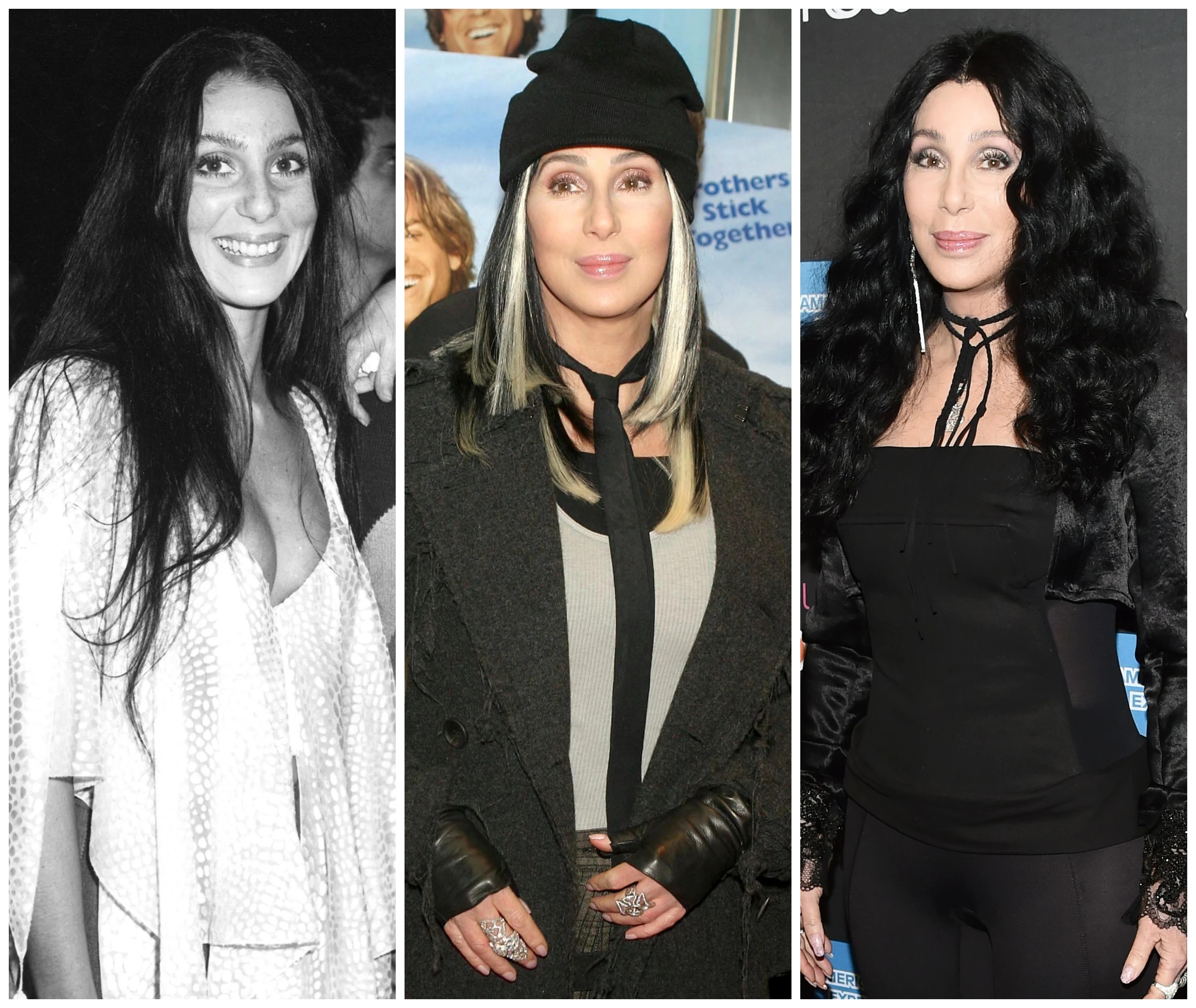 Cher | 15 Celebs Who Openly Admit to Going Under the Knife | Zestradar