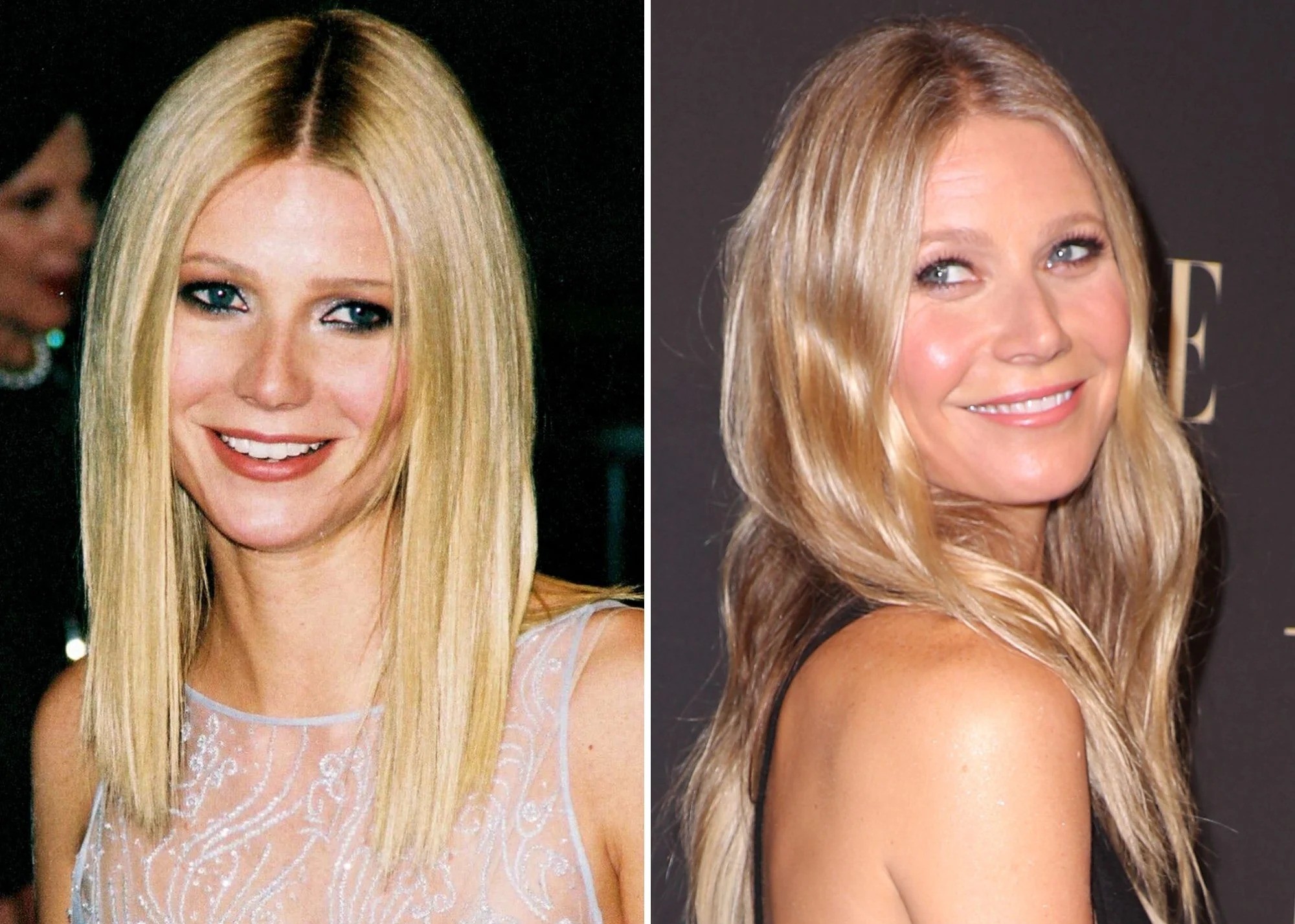 Gwyneth Paltrow | 15 Celebs Who Openly Admit to Going Under the Knife | Zestradar