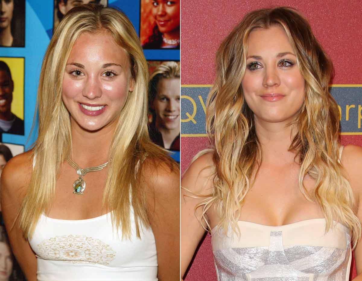 Kaley Cuoco | 15 Celebs Who Openly Admit to Going Under the Knife | Zestradar