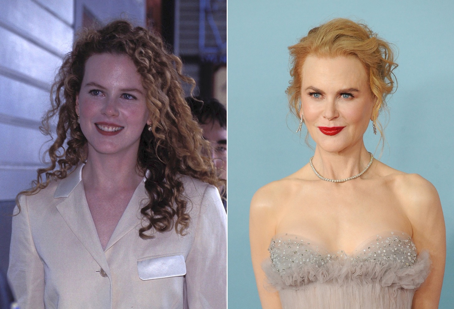 Nicole Kidman | 15 Celebs Who Openly Admit to Going Under the Knife | Zestradar