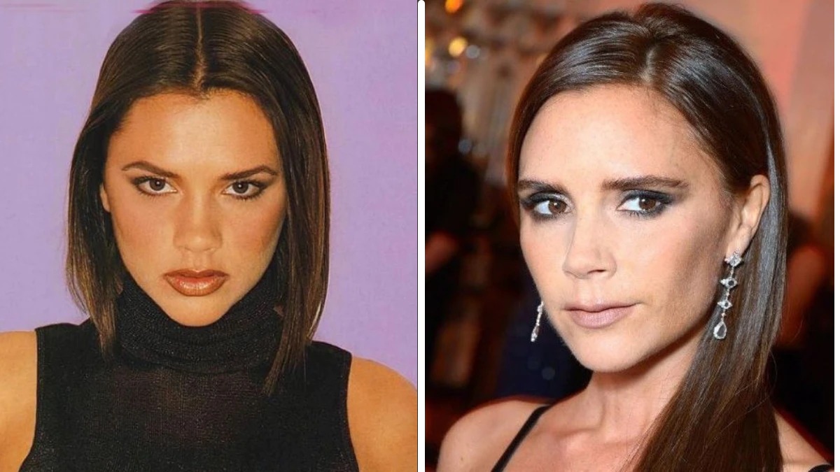 Victoria Beckham | 15 Celebs Who Openly Admit to Going Under the Knife | Zestradar