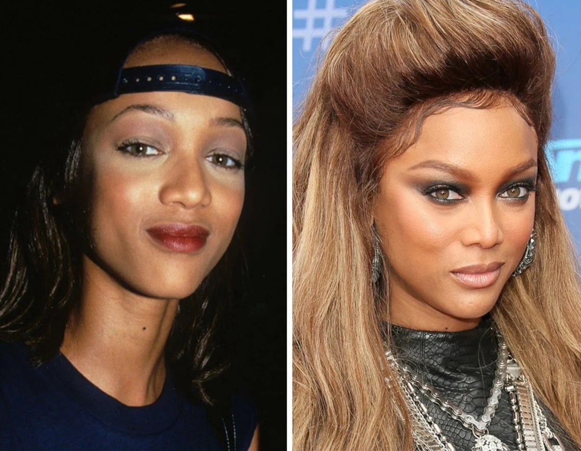 Tyra Banks | 15 Celebs Who Openly Admit to Going Under the Knife | Zestradar