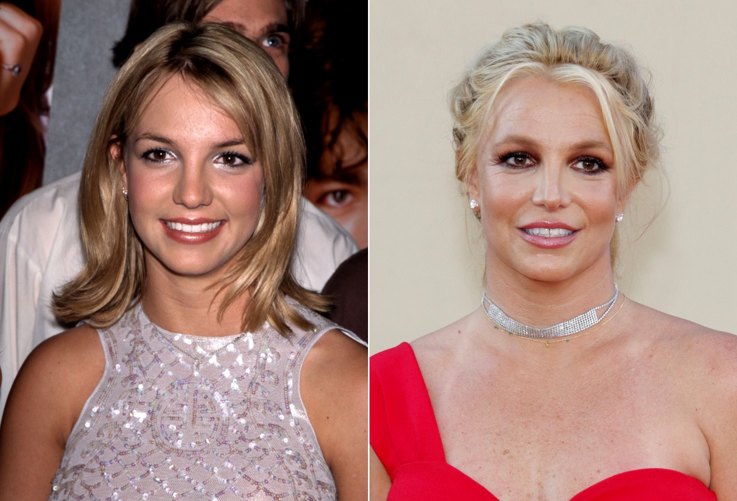 Britney Spears | 15 Celebs Who Openly Admit to Going Under the Knife | Zestradar