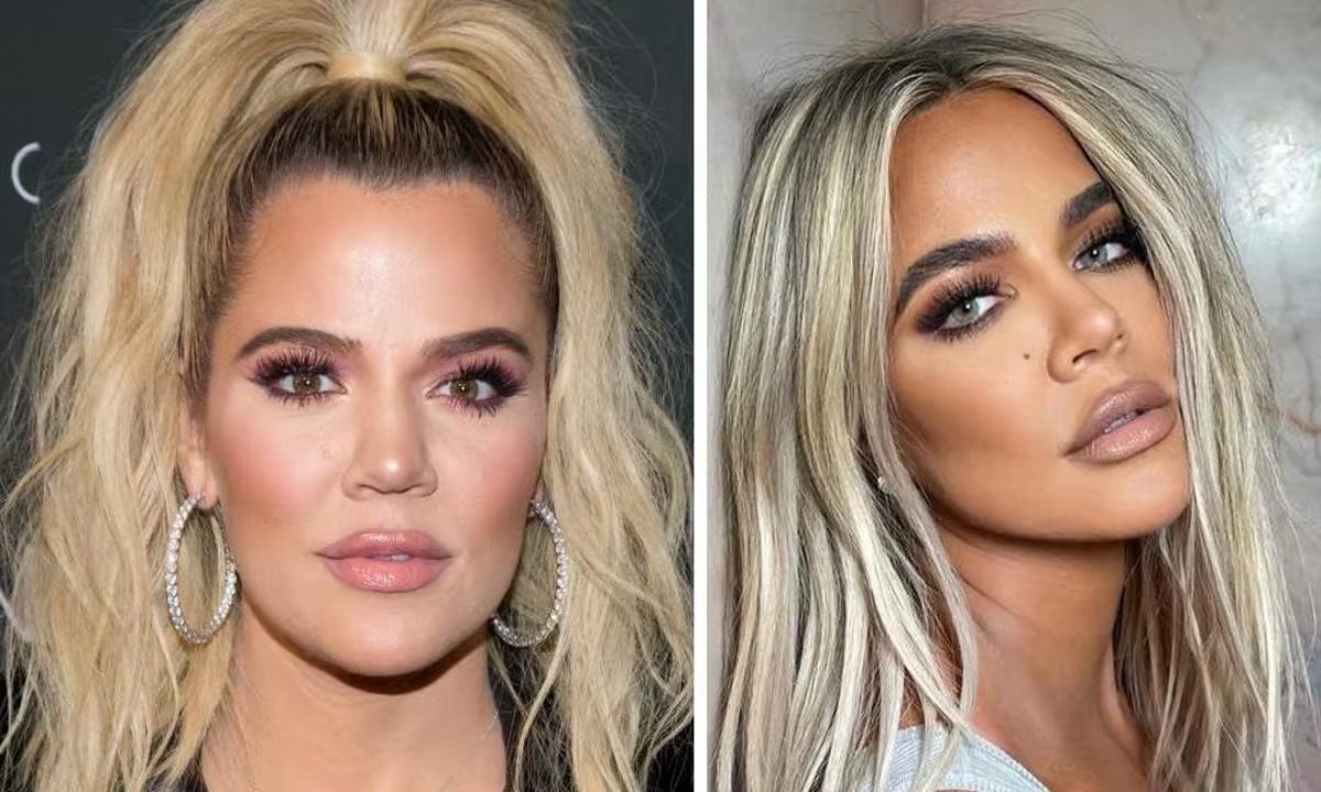 Khloe Kardashian | 15 Celebs Who Openly Admit to Going Under the Knife | Zestradar