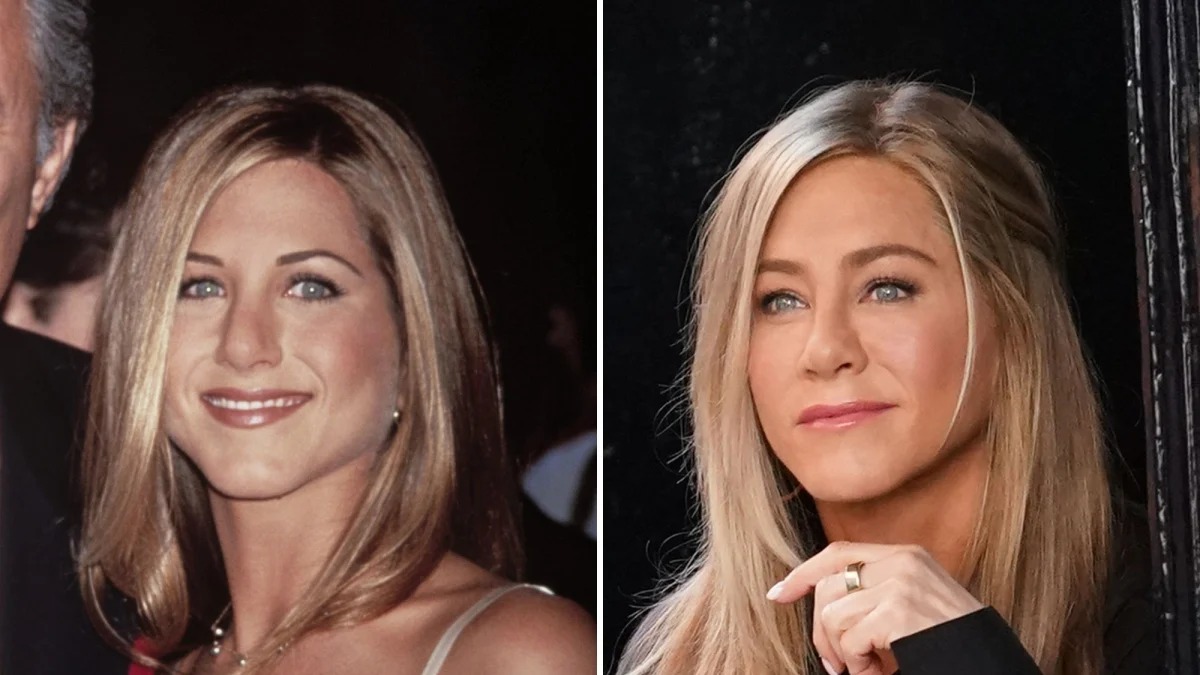 Jennifer Aniston | 15 Celebs Who Openly Admit to Going Under the Knife | Zestradar